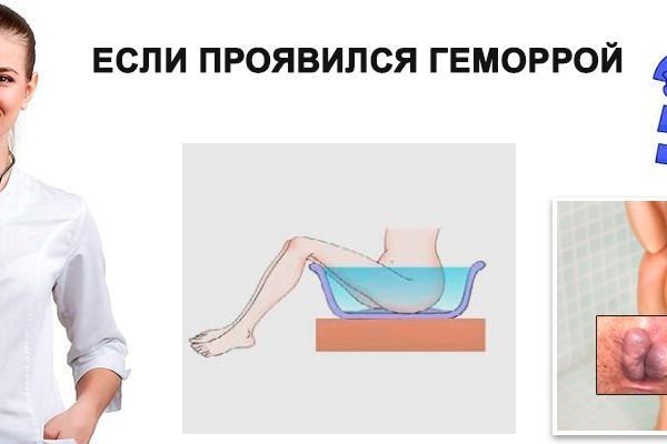 Кракен маркет даркнет слушать